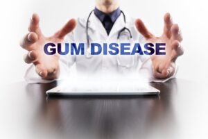 Gum disease and dentist